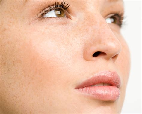 What Can You Do If You Want To Get Rid Of Chubby Cheeks?