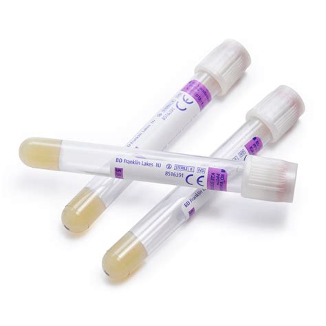 Ppt Plasma Preparation Tube at Donald Edwards blog
