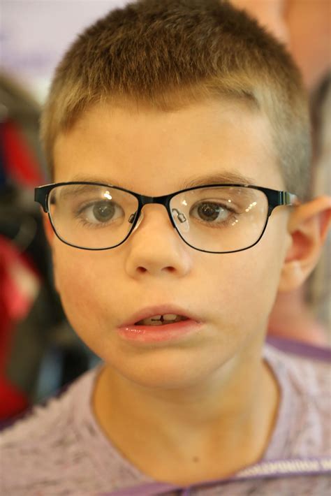 Para Profissionais Médicos: Diagnosticando a Síndrome de Moebius - Moebius Syndrome Foundation