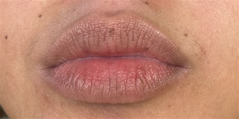 Lip Salvation: How Dermtropics Nourishing Lip Shield Transformed My Dry Lips — Project Vanity