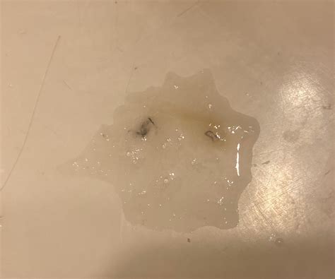 Black spots in mucus? : r/medical