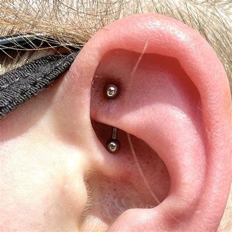 Rook Piercing Keloid