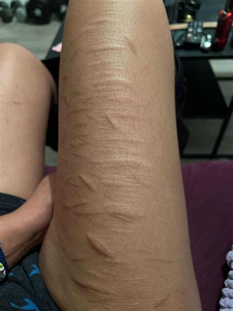 Does anyone know why they get bumpy under them? They go away once they turn white. : r/SelfHarmScars