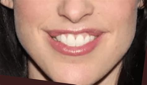 Catherine Reitman Lips - HealthCarter