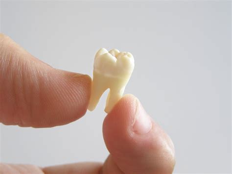 Does Losing a Back Tooth Really Matter | Blog | CC Dental