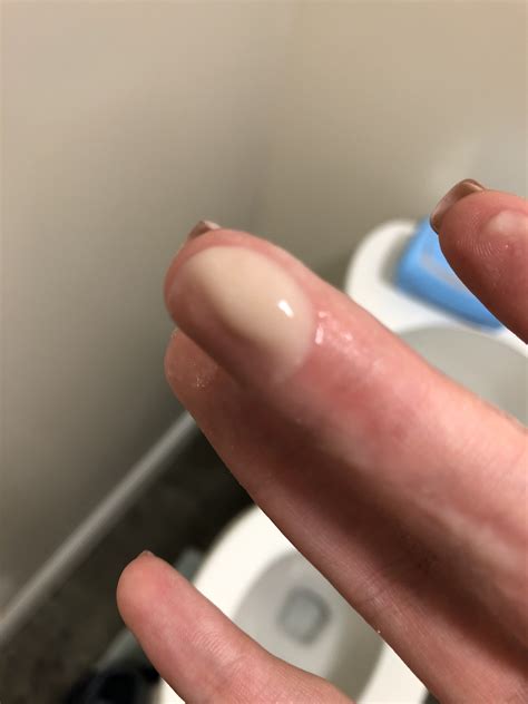 Creamy Discharge Before Period