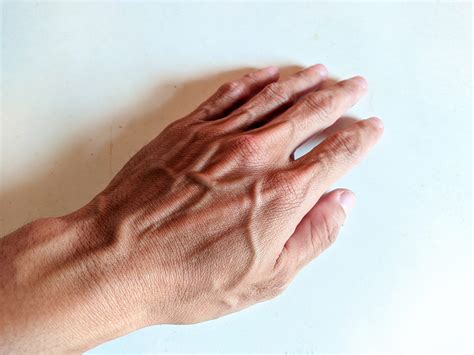 Visible Hand Veins and Why You Have Them | The Vein Centre