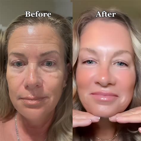 9 Benefits of Bio-Collagen Masks For Dry, Menopausal Skin – quasi