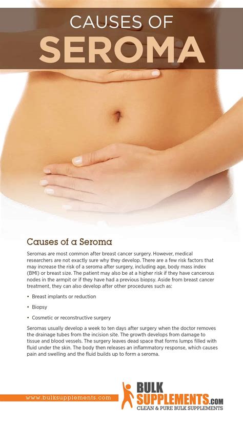 What is a Seroma: Causes, Characteristics & Treatment