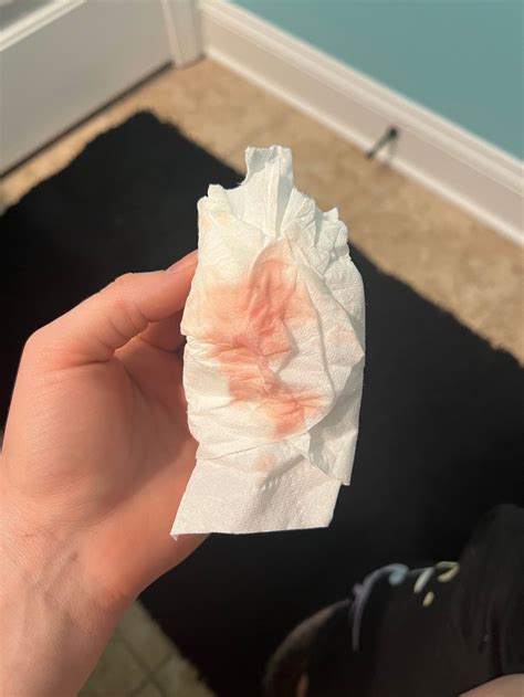 Implantation bleeding | BabyCenter