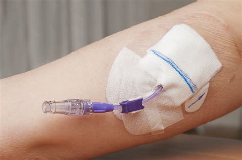 Picc Line Temoignage: Picc Line Schéma – GMLYP