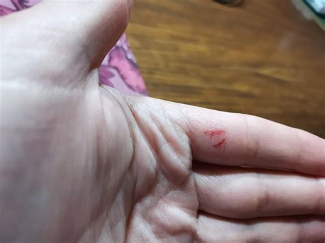 Bearded Dragon Bite Wound