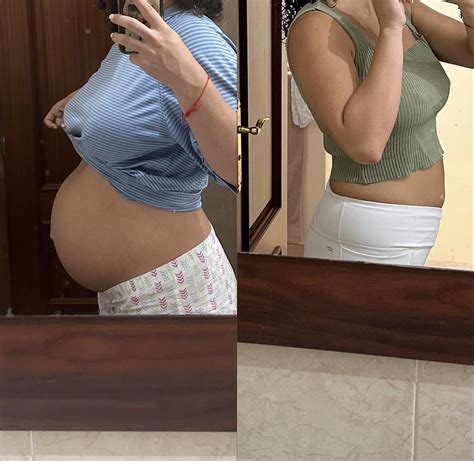 2 Weeks Post Partum Belly Diastasis Recti, The Post Pregnancy Belly