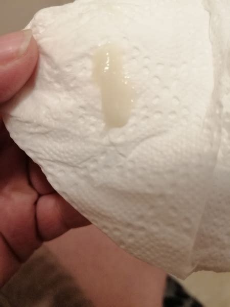 Mucus Plug Discharge Pieces