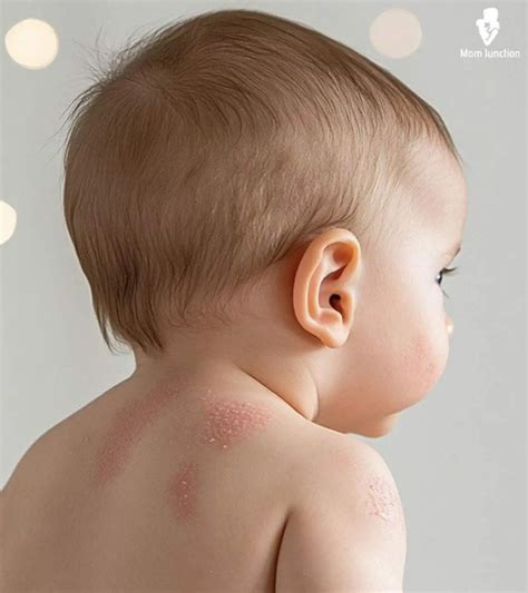 What Are Little Red Dots On Baby Skin