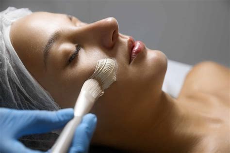 How Chemical Peels Help With Acne and Pigmentation - Healthylooks Medspa