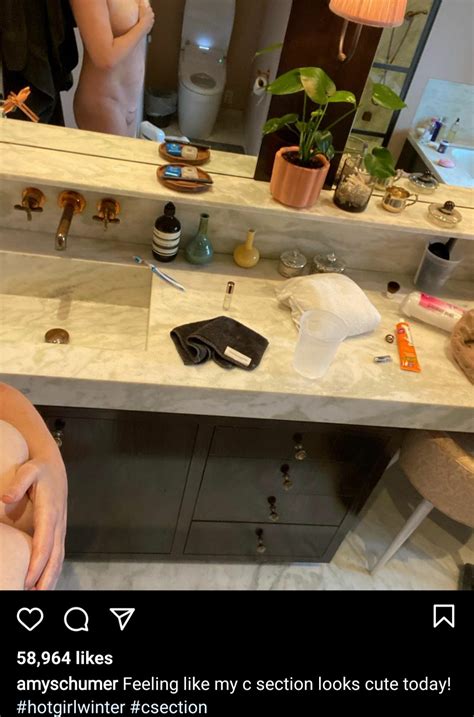 Amy Schumer goes naked to show off her C-section scar