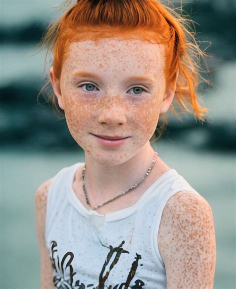 Freckles | Beautiful freckles, Freckles, Red hair freckles