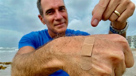 Florida's Vibrio vulnificus, 'flesh-eating bacteria' cases dropped in 2025