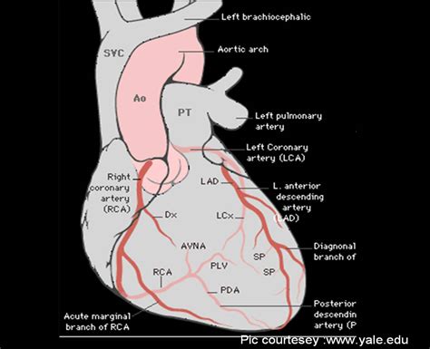 What is the clinical significance of ramus intermedius coronary artery ...