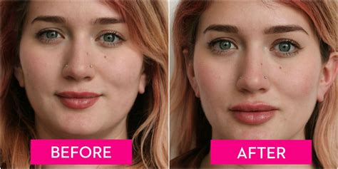 How Expensive Is It To Get Your Lips Done | Lipstutorial.org
