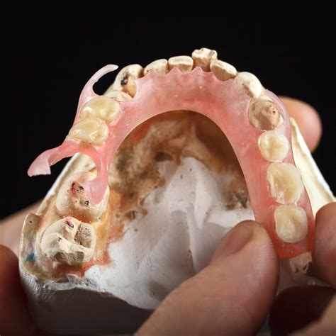 Denture near me — Life.Dental