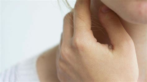 Ganglios inflamados en el cuello por el estrés: causas y consejos