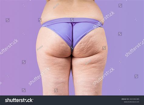 Overweight Thigh Woman Fat Hips Buttocks Stock Photo 2223301385 | Shutterstock