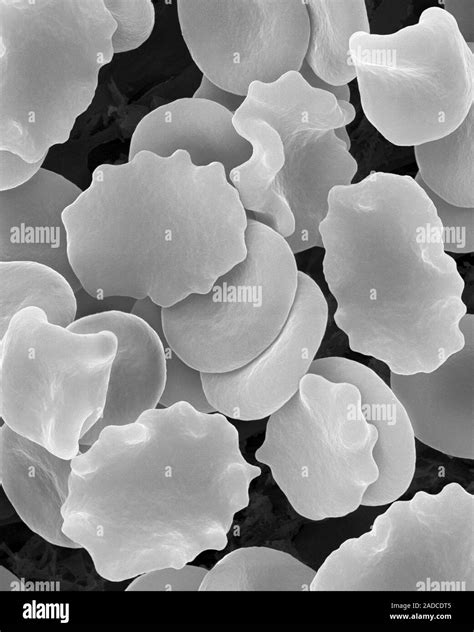 Human red blood cells in hypertonic solution (1.01% NaCl), scanning ...