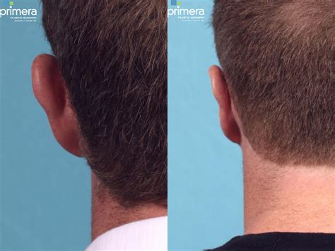 Ear To Pin Ears Back at Barbara Keeter blog