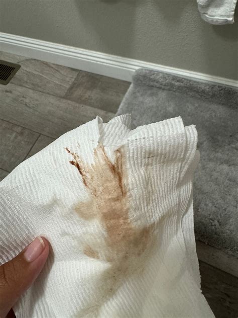 Light pink /Brown discharge. 7 weeks pregnant | BabyCenter