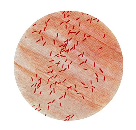 E Coli Micrograph