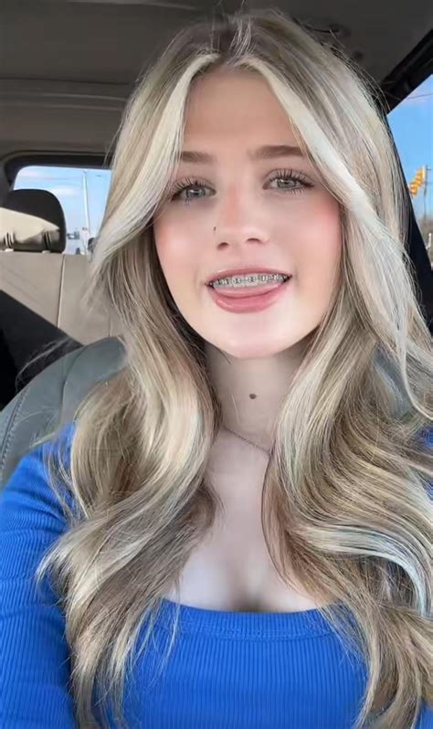 Am I hot enough to pull off braces? : r/BracesPorn