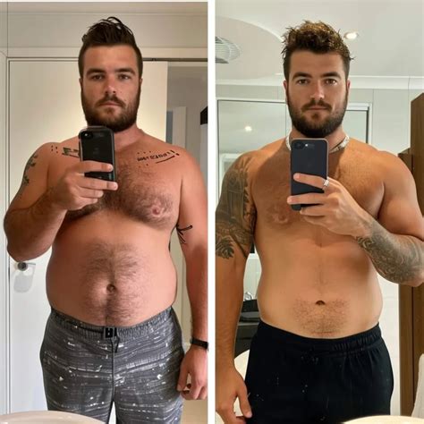 Discover Tesamorelin in Newport Beach, CA. - Alpha Rejuvenation