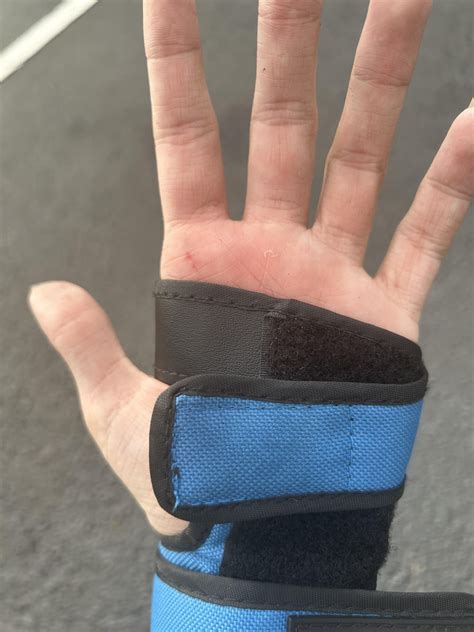 bruised palms w/ wrist guards: user error, improper gear, or par for the course? : r/Rollerskating