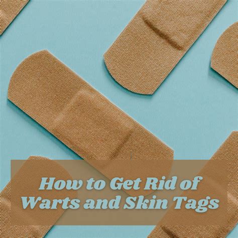 How to remove skin tags and warts on your body naturally – Artofit