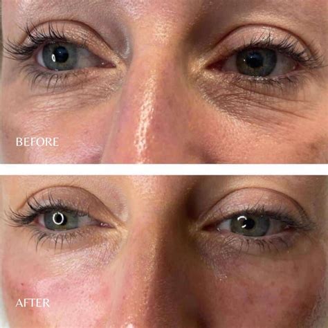 Lumi Eyes Behandeling - Maak Afspraak - The Swan Beauty Center