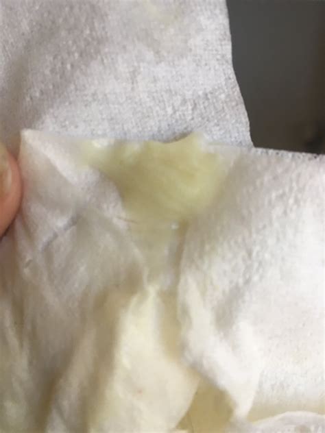 What Does Mucus Plug Look Like With No Blood at Kevin Francis blog