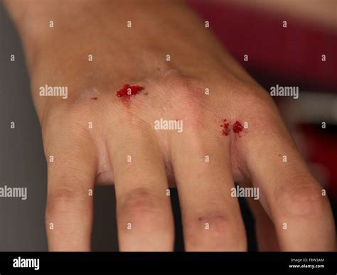 Blood cut bandaid hi-res stock photography and images - Alamy