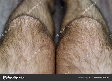 Very Hairy Male Legs Beauty Male Body — Stock Photo © zagovoreny #515230402