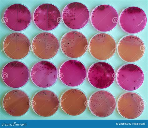 Agar Plates with Bacteria Colonies in Various Petri Dish Stock Photo ...