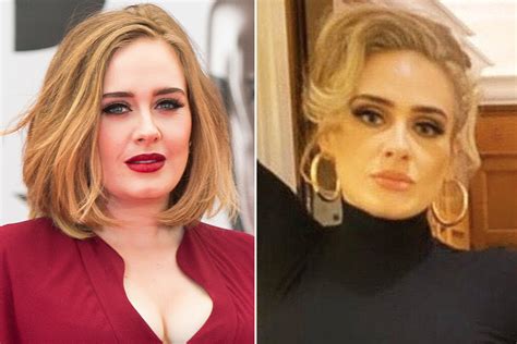 Adele Before And After Nose Job