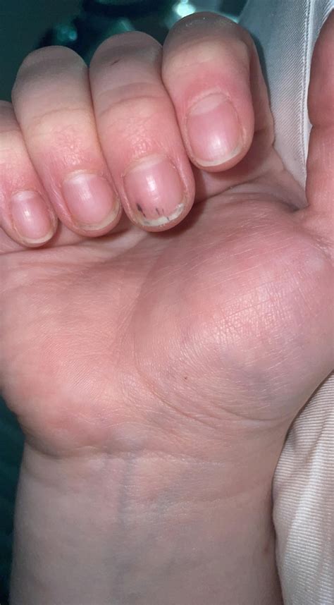 24F in Colorado (notorious for skin cancer). Found this new slightly ...