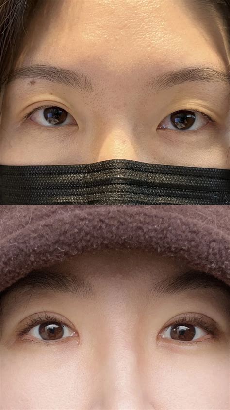 Korean double eyelid online