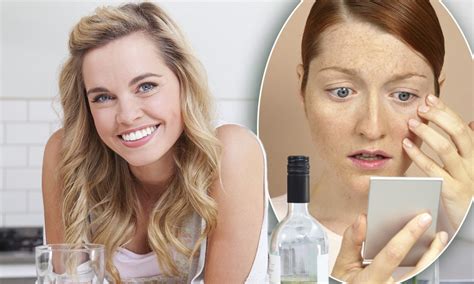 Alcoholic Face Swelling