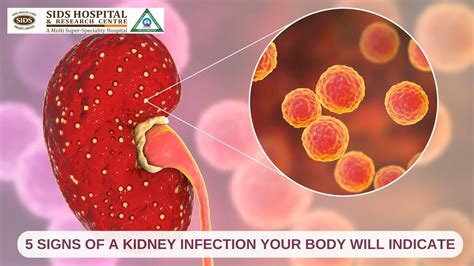 5 Signs of a Kidney Infection Your Body Will Indicate: A Guide from the best Kidney Specialist ...
