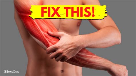 How to Fix Arm Muscle Pain in 30 SECONDS | SpineCare