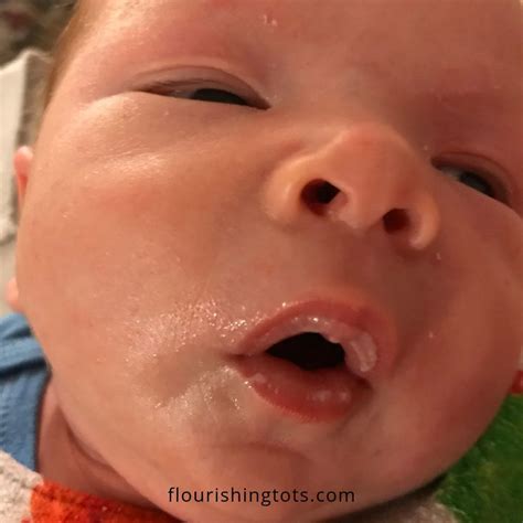 Why Are My Baby S Lips White After Nursing | Lipstutorial.org