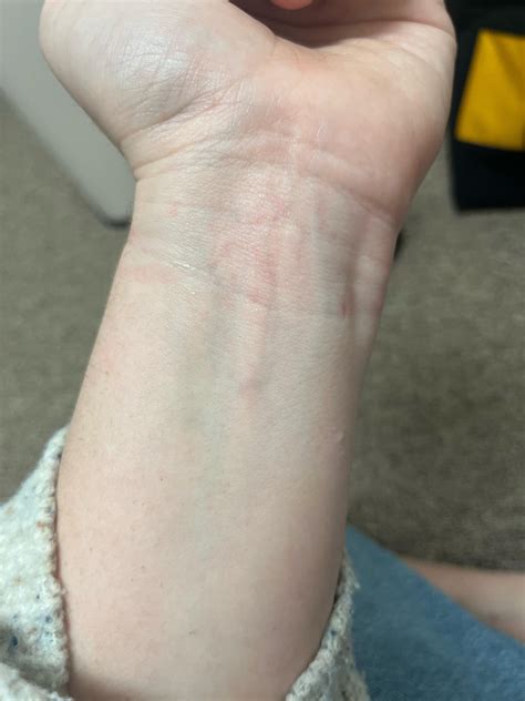 What color are my veins? : r/coloranalysis