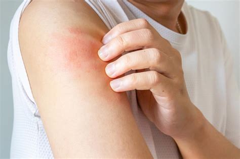 Scratching Your Itch Feels Amazing – But Here’s What It’s Really Doing to Your Skin